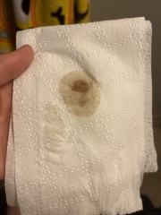 Bleeding 7dpo??