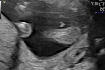Boy or girl?