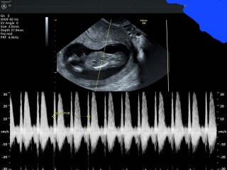 Boy or girl?