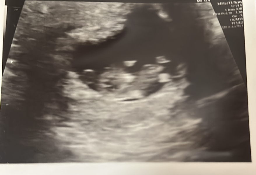 Anyone due in April 2024? #2