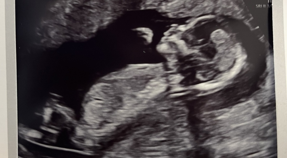 Guess the gender?