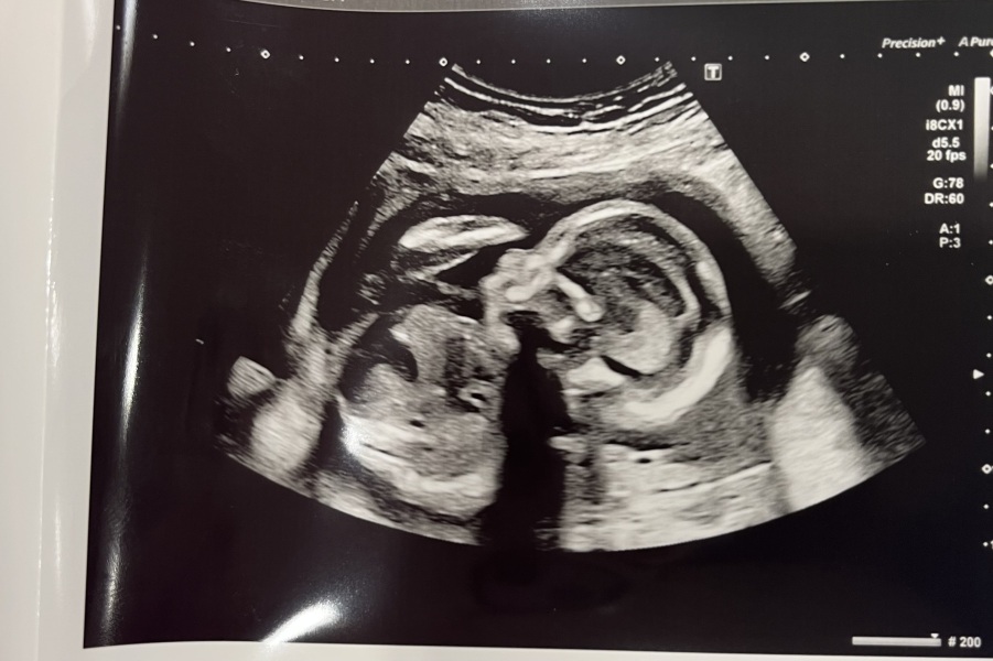 March 2024 second trimester onwards