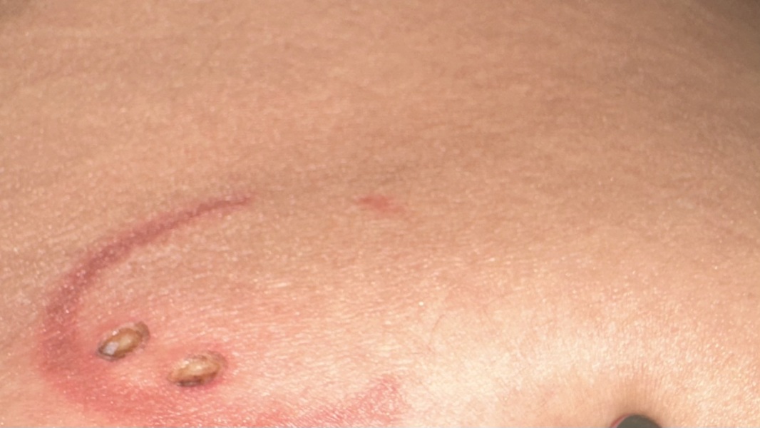 Can anyone tell what this mark is?