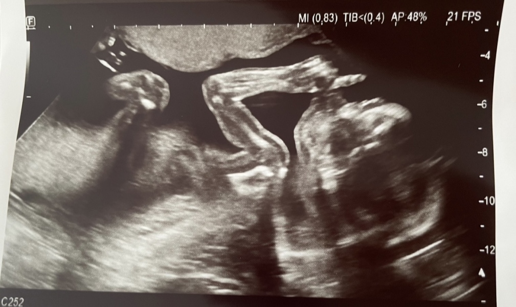 March 2024 second trimester onwards