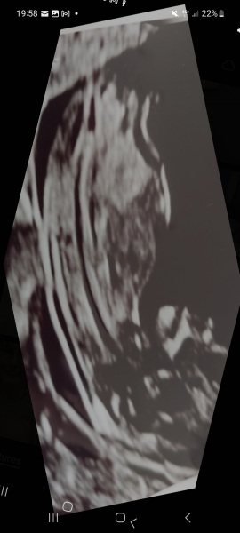 Calling all nub pros! Is this a girl or a boy? 12+4.