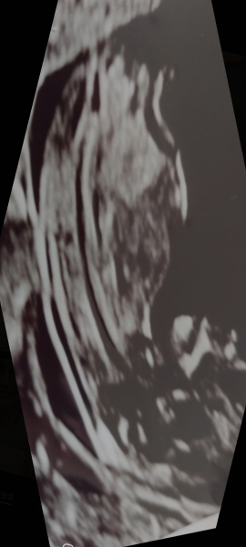 Calling all nub pros! Is this a girl or a boy? 12+4.