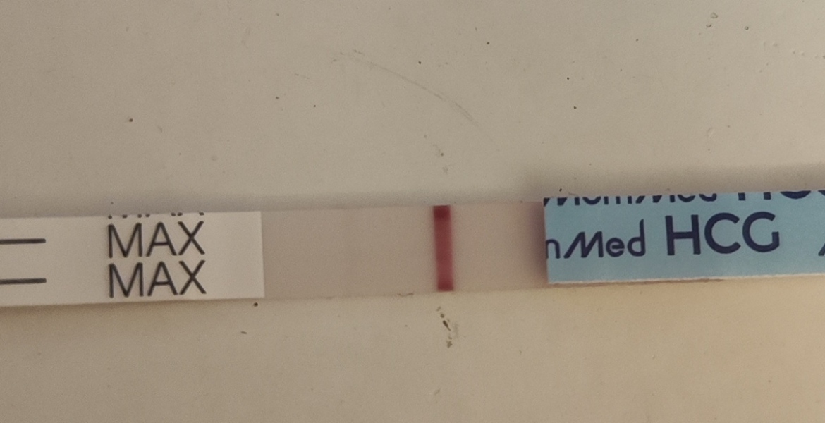 Leg pain before BFP??? TWW 8DPO