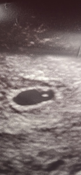 HELP with scan picture!