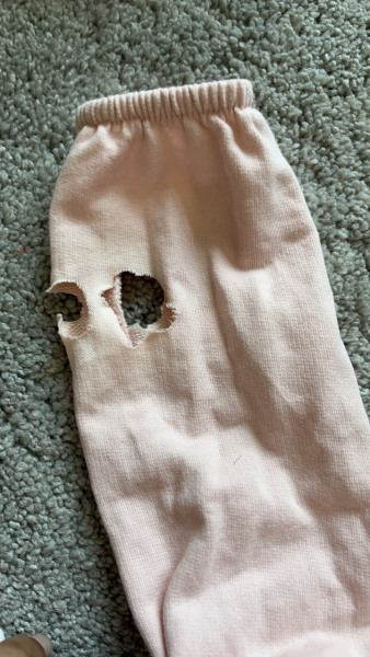 Does this look like a rat chewed on this dress?