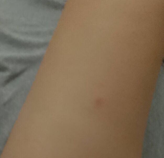 What has bitten me? (Pics)