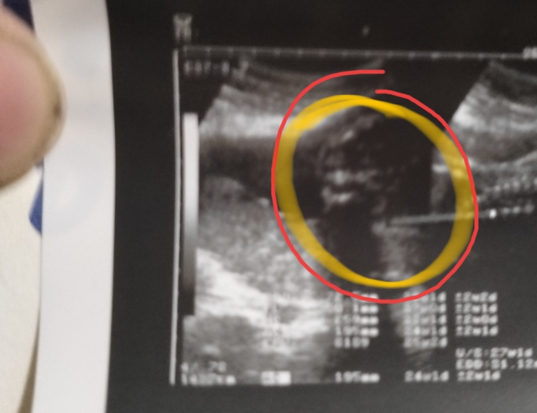 Potty Shot! Girl or Boy? 