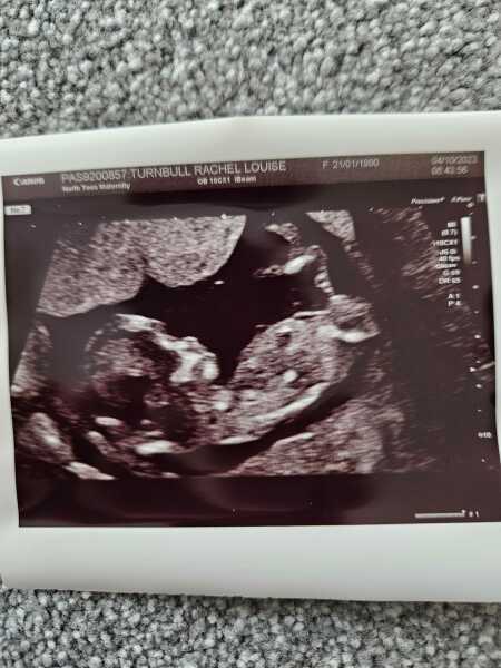 Boy or Girl (12 week scan) ???