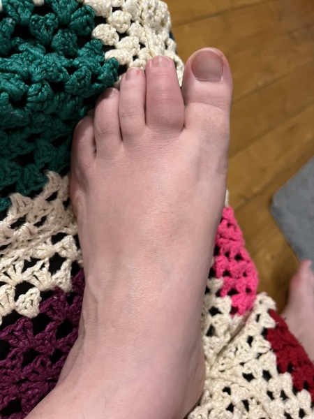 Anyone know anything about feet?