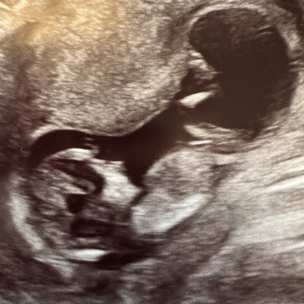 Late April 2024 / Early May 2024