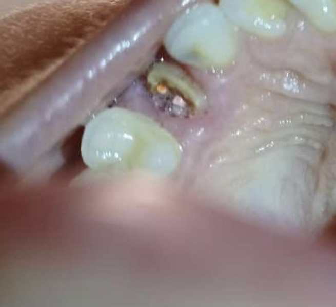 Any dentists please help