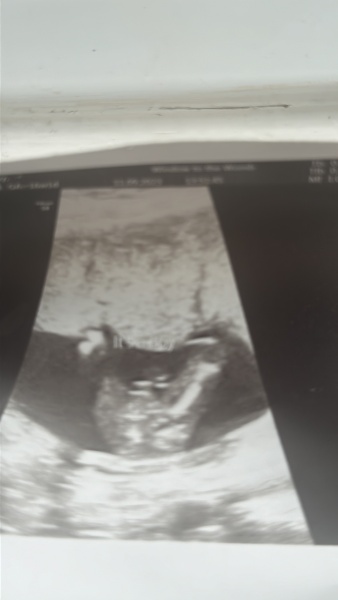 Can’t tell if this is a boy?