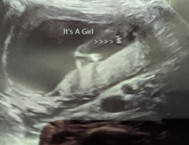 Is our gender scan wrong?