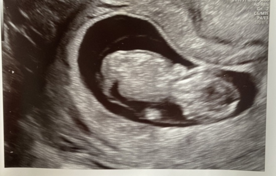 Gender Guesses!