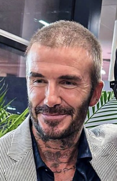 Has David Beckham had work done?
