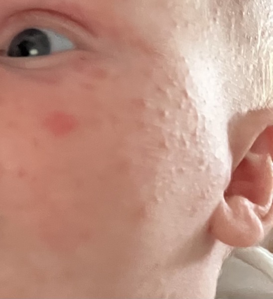 Possible intolerance in EBF baby (warning: nappy picture)