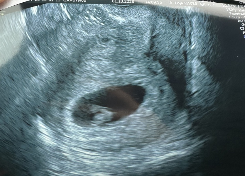 Due May 2024?