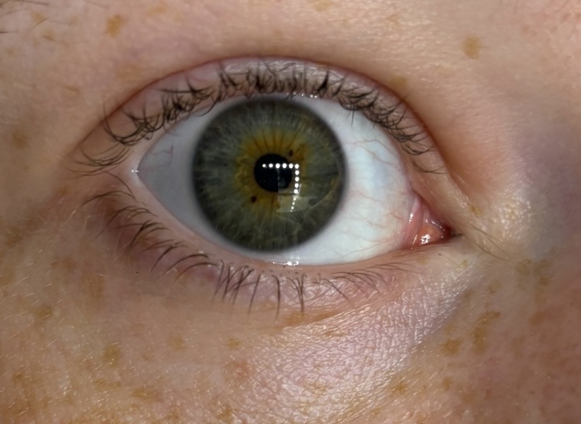What colour are my eyes? (Pic included!)