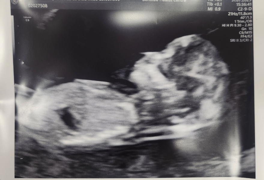 Boy or girl