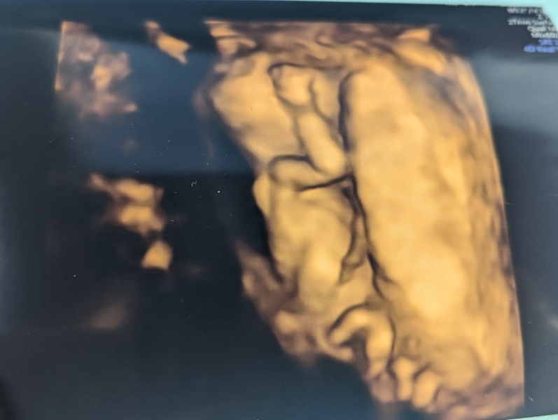 FET/IVF July 2023 - Thread 4