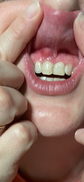 Is this an abscess? Apologies for such a gross picture