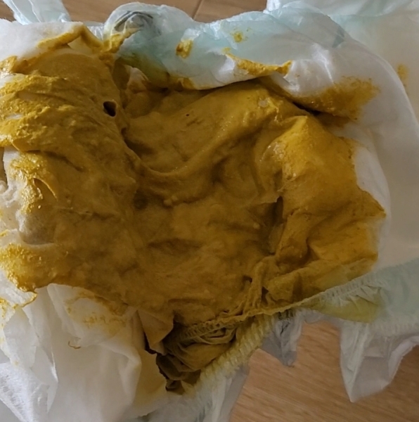 Baby possible allergy