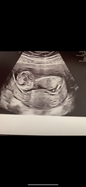 Boy or Girl