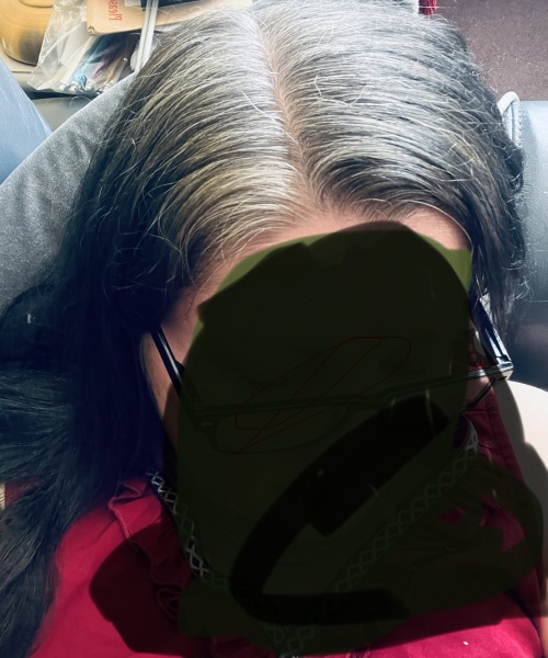 To just grow out grey hair?
