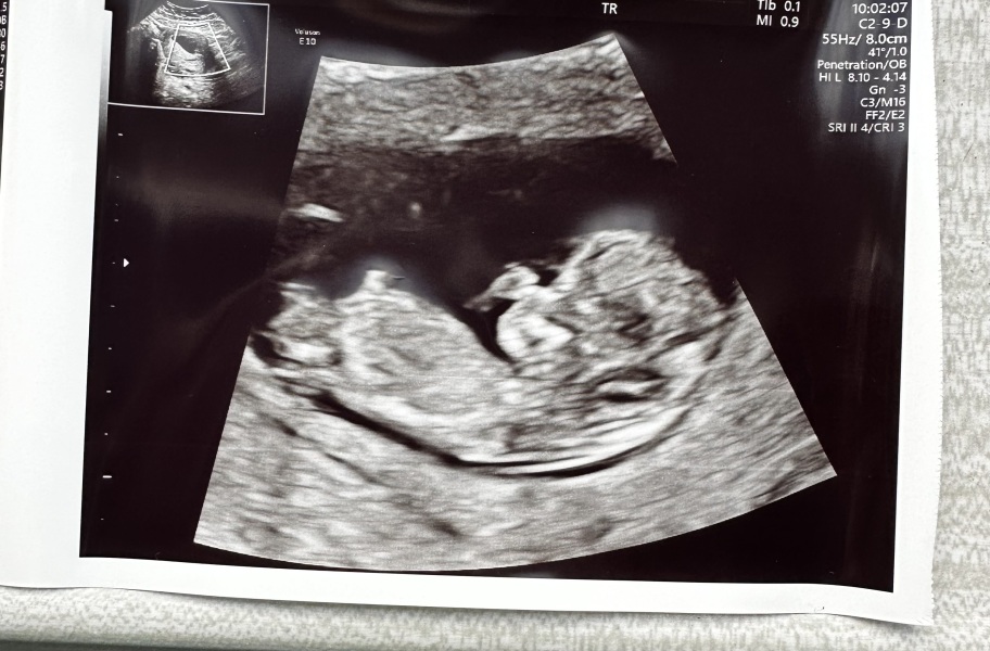 Boy or Girl? Help! 💙🩷