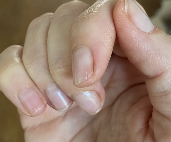 Using gel polish over split nail