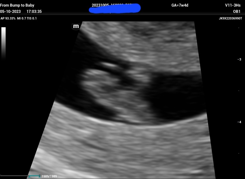Due May 2024?