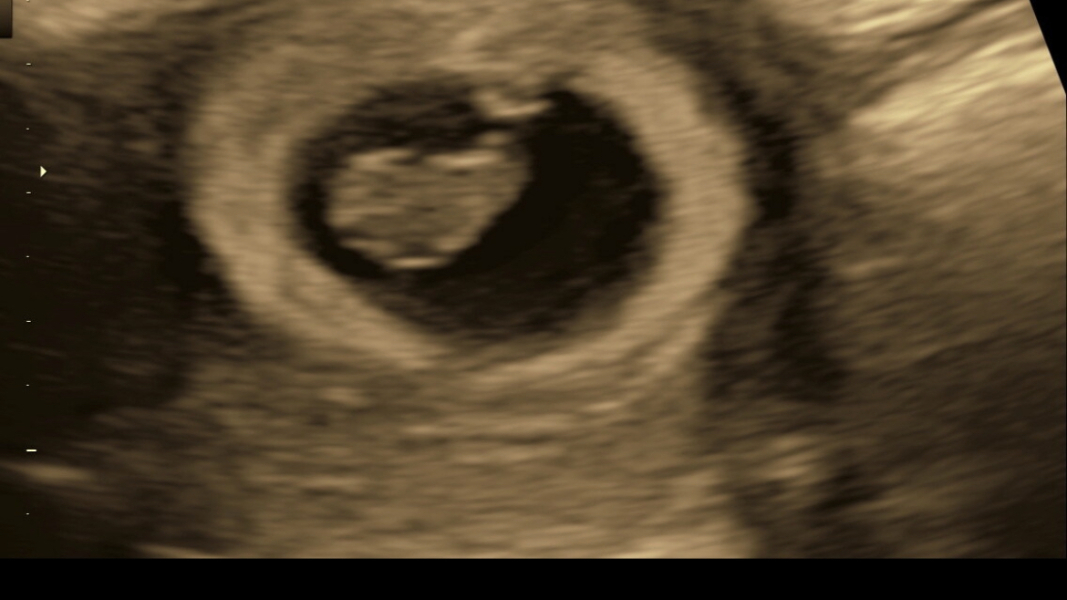 Due May 2024?