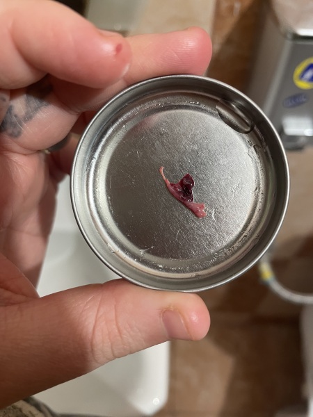 Is this a miscarriage? Please help. TRIGGER WARNING : PHOTOS