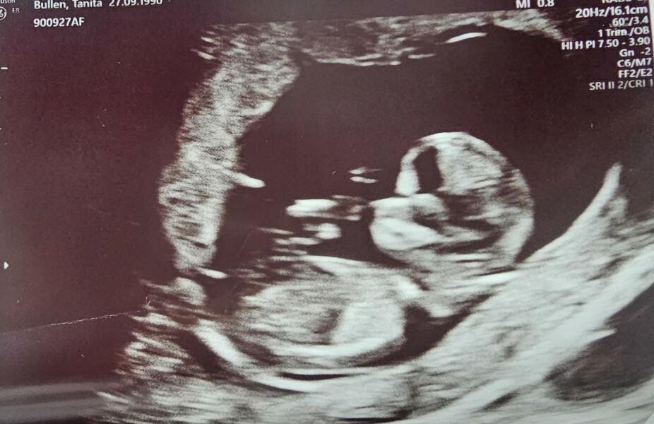 Boy or girl