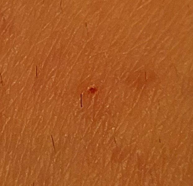 Could this be a tick? (picture included)