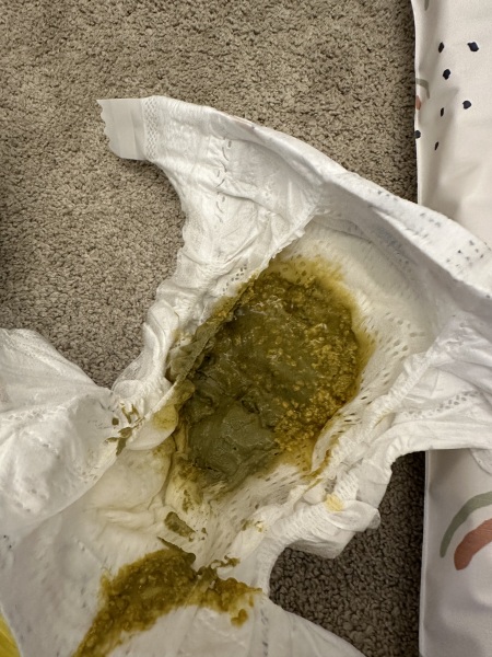 Warning: poop pic. / is this normal, potential CMPA