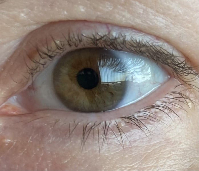 What colour is this eye?