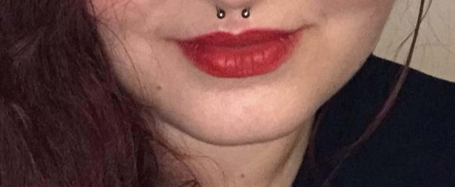 Can you tell I’ve had lip filler?