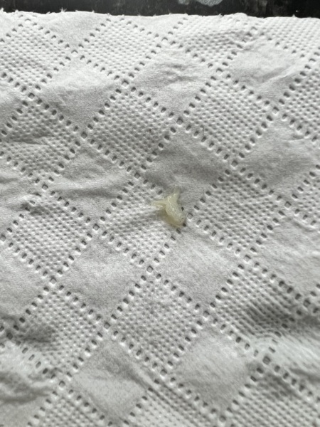 TMI - is this a part of a mucus plug?
