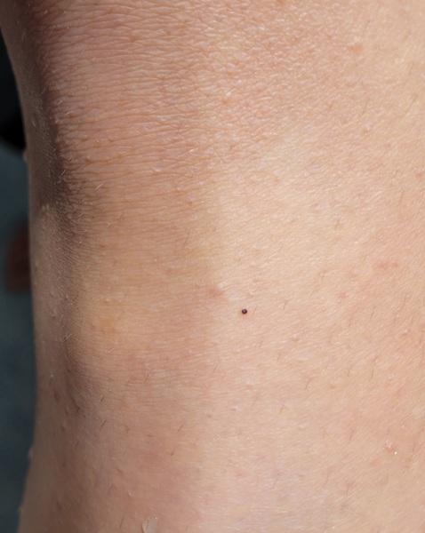 Could this be a tick? (picture included)