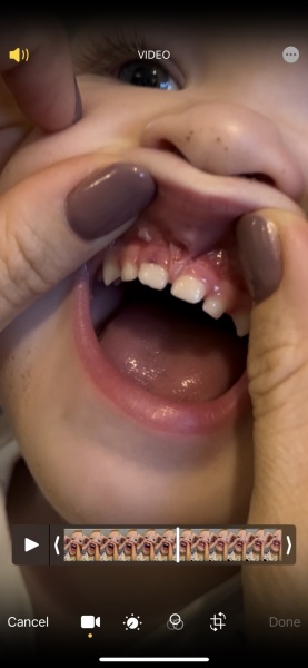 Would you take your child to A&E for this??