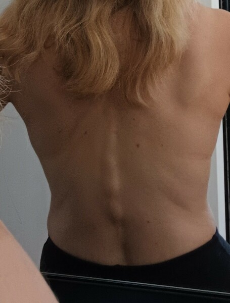 Worried about my back
