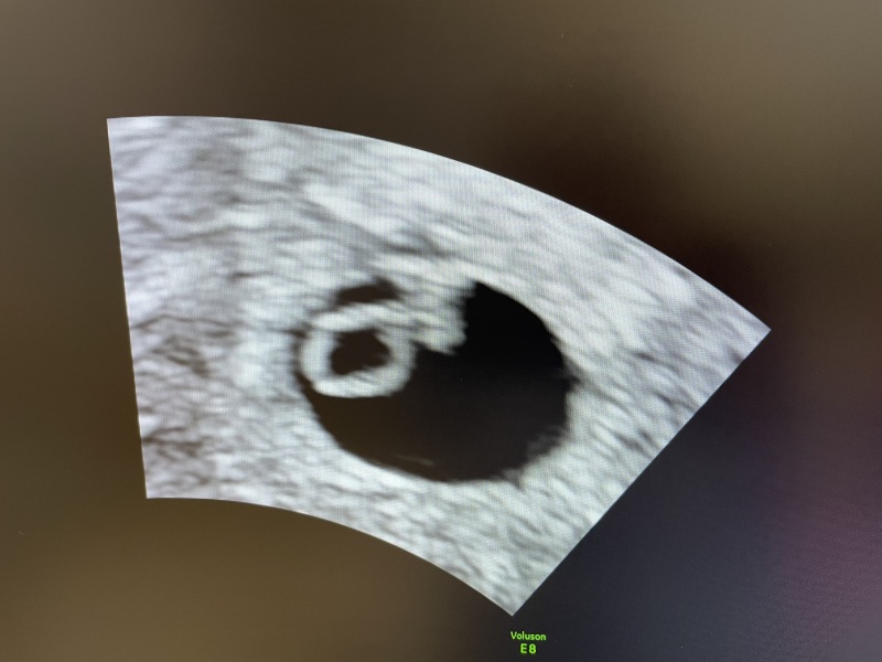 Due May 2024?