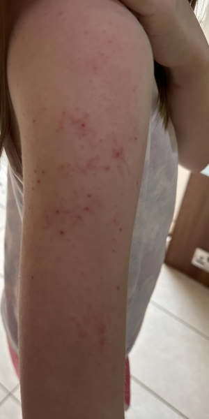 Anyone know what this rash could be