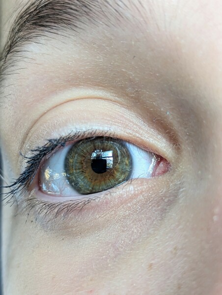 What colour is this eye?