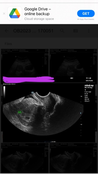 Early scan.